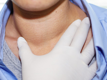Tratamiento de enfermedades de tiroides
